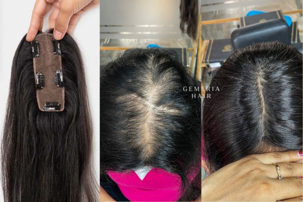 perfect solution for hair thinning